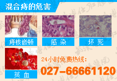 混合痔的危害