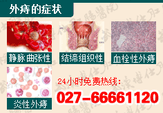 外痔类型