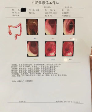 直肠肿瘤报告检查单
